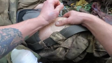 A Russian soldier (doctor) saves the life of Ukrainian soldiers