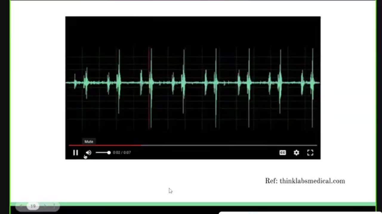ST3.Examine the respiratory system of this 58 year old man with SOB