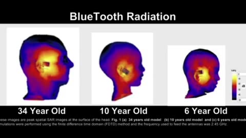 MICROWAVED BRAINS! LOOK AT THE PROPAGANDA BEING PUSHED TO DEFLECT ABOUT THE DANGERS OF EMF'S!