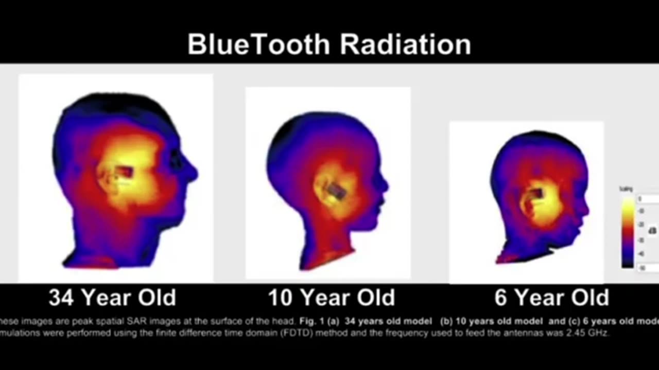 MICROWAVED BRAINS! LOOK AT THE PROPAGANDA BEING PUSHED TO DEFLECT ABOUT THE DANGERS OF EMF'S!