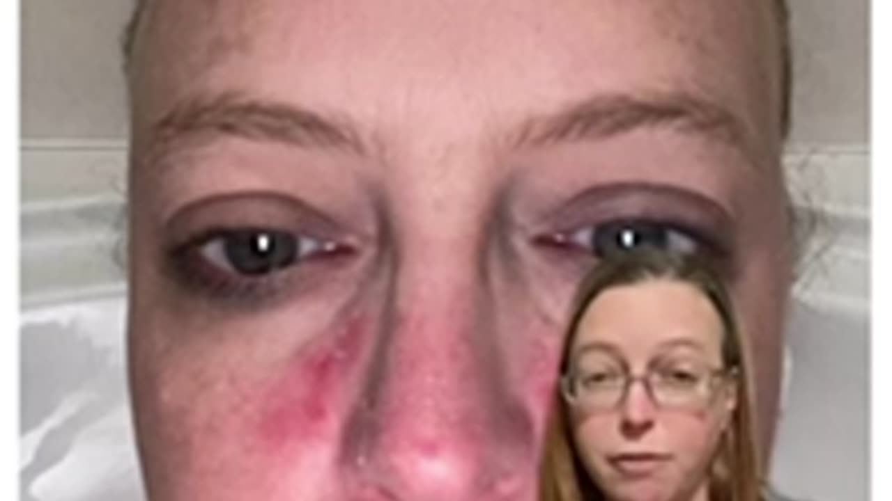 Ivermectin Testimony