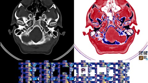 BLUE STEEL: CT Scan + ANZ flag art + Windows icons + AČE-20 Alphabet (10s*20fps*768p)