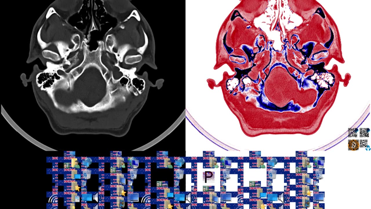 BLUE STEEL: CT Scan + ANZ flag art + Windows icons + AČE-20 Alphabet (10s*20fps*768p)