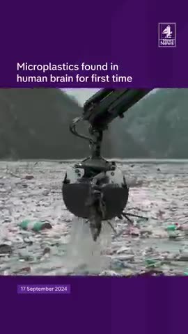 Microplastics found in human brain for first time