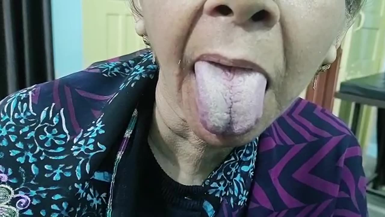 Abnormal tongue movement