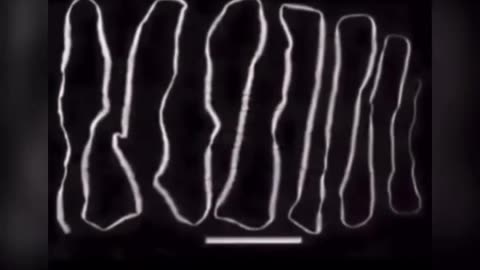 ¡¡¡Mucho cuidado!!! Los Parasitos han matado a mas humanos que todas las guerras juntas