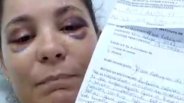 Governador Helder Barbalho Paciente luta pela Vida, está internada no Hospital do Estado do Pará
