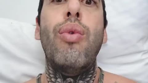 CHRIS SKY💥RED🚨ALERT🚨👀😨😱🤬😡🤬
