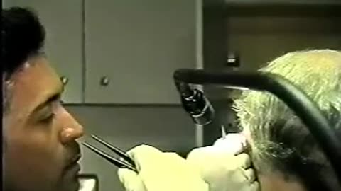 Whitley's Implant Removal