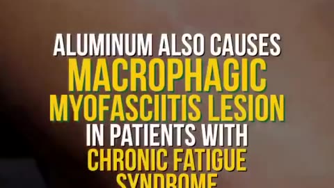 This is where aluminum goes in your body after vaccination.