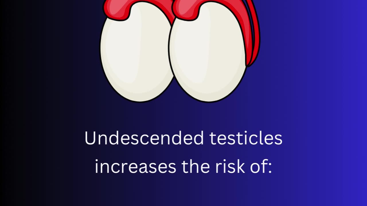 Undescended Testicles ("balls") in Baby Boys
