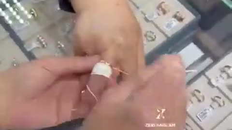 How to get a ring off a swollen finger