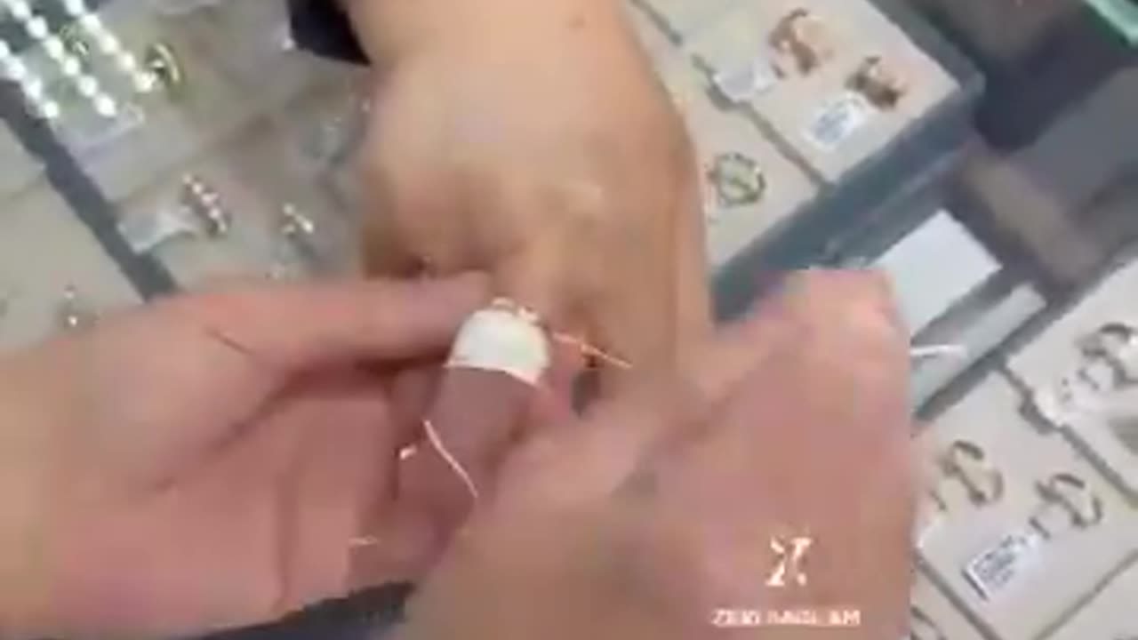 How to get a ring off a swollen finger