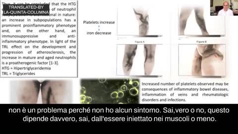 Termografia di vaccinati. ( Dr. Felipe Reitz)