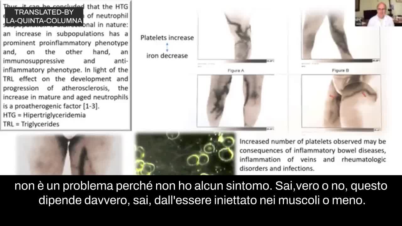 Termografia di vaccinati. ( Dr. Felipe Reitz)