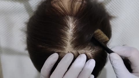 ASMR | Brain Melting | Scalp Scratching Sounds | Stress Relief | No Talking | Binaural