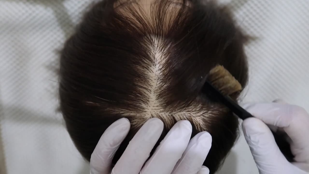 ASMR | Brain Melting | Scalp Scratching Sounds | Stress Relief | No Talking | Binaural