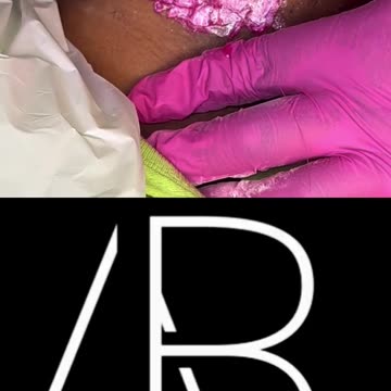 Transformative Face Waxing Journey | Using Sexy Smooth Tickled Pink Hard Wax