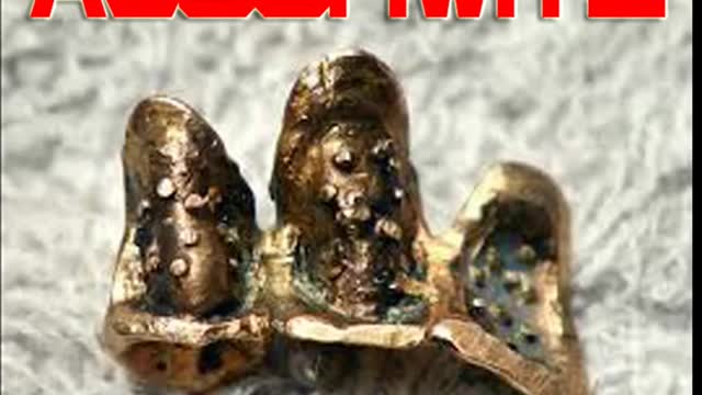 BREAKING: 87, 000 new IRS agents in the USA trained in removing teeth.