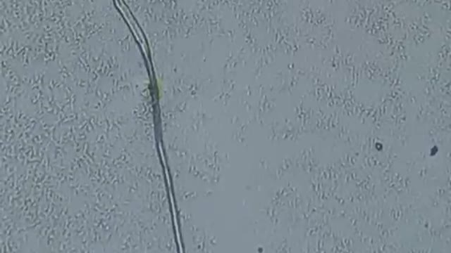 Strange objects inside the Pfizer covid vaccine with proof