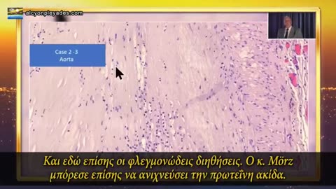 ΓΕΡΜΑΝΟΙ ΠΑΘΟΛΟΓΟΙ ΔΕΙΧΝΟΥΝ ΟΤΙ Η ΠΡΩΤΕΪ́ΝΗ ΑΚΙΔΑ ΑΝΑΠΑΡΑΓΕΤΑΙ ΣΕ ΟΛΑ ΤΑ ΟΡΓΑΝΑ ΤΟΥ ΣΩΜΑΤΟΣ