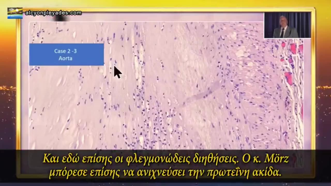 ΓΕΡΜΑΝΟΙ ΠΑΘΟΛΟΓΟΙ ΔΕΙΧΝΟΥΝ ΟΤΙ Η ΠΡΩΤΕΪ́ΝΗ ΑΚΙΔΑ ΑΝΑΠΑΡΑΓΕΤΑΙ ΣΕ ΟΛΑ ΤΑ ΟΡΓΑΝΑ ΤΟΥ ΣΩΜΑΤΟΣ