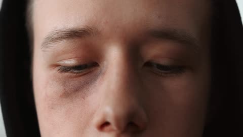 Amazing Therapy Video