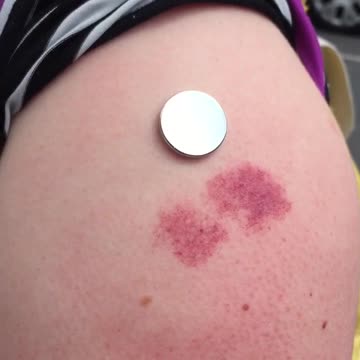 Nano Antennas are what the Jabbed are( electromagnetic) without their knowledge or consent