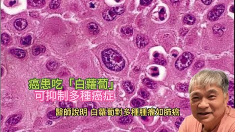 癌患吃「白蘿蔔」 可抑制多種癌症