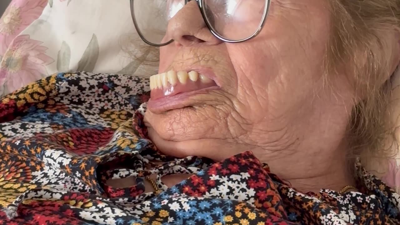 Woman Nearly Loses Her Dentures During Nap