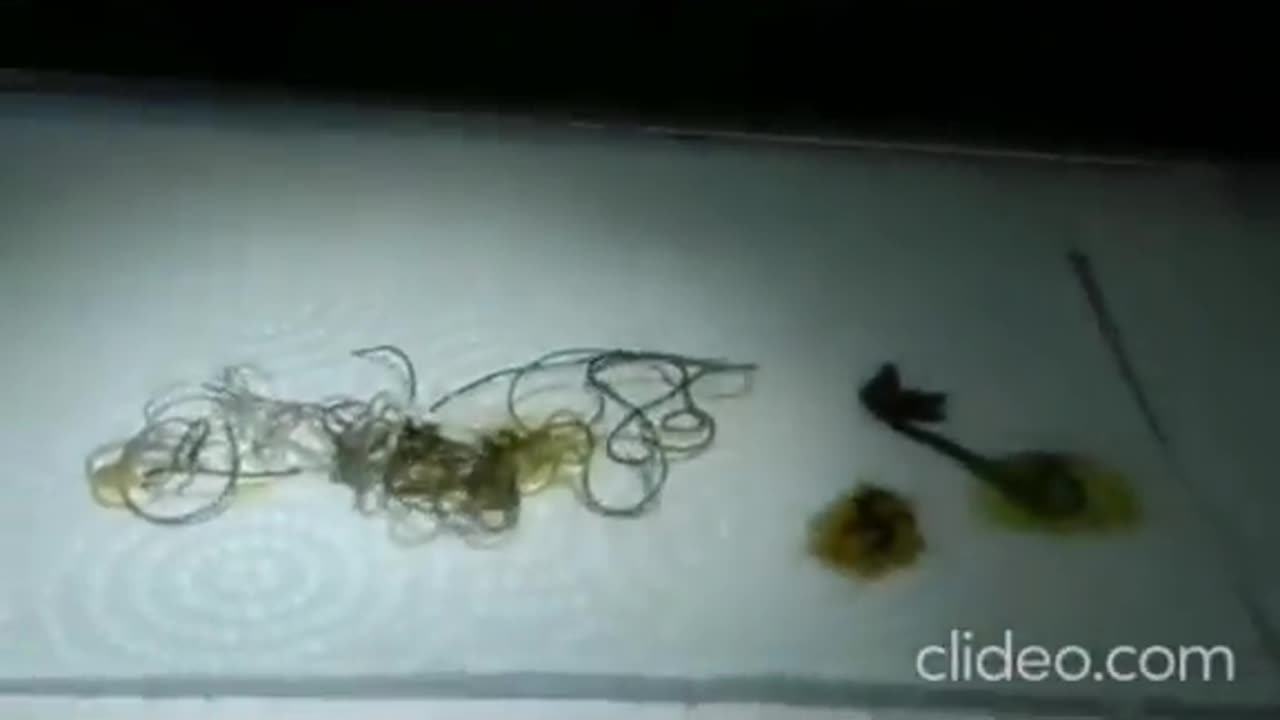 Pulling parasites out of a grasshopper.