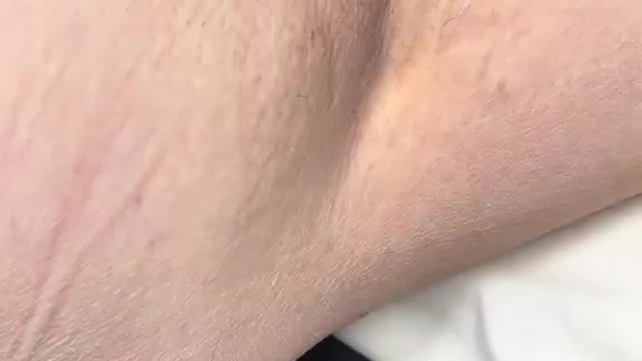 Underarm Waxing with Sexy Smooth Tickled Pink Hard Wax by @xobeautywax