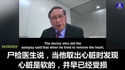 “日本 重磅消息”腫瘤權威暨京都大學 名譽教授 福島正典 教授，譴責新冠疫苗實驗針劑接種本質就是“謀殺”，尤其導致惡性、發展快速且特定類型的“渦輪癌”與“超額死亡”！真不妙…