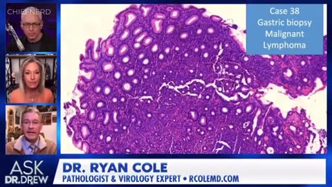 Dr. Ryan Cole’s Biopsy Results May Explain The Shocking Rise In “Mysterious” Cancers