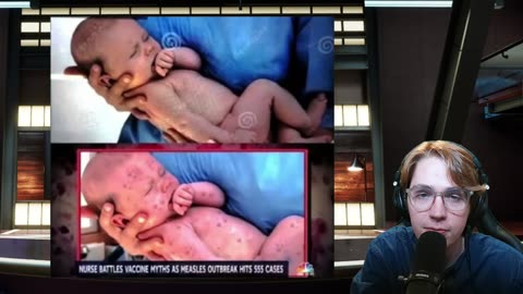 NBC News Caught FAKING Measles Baby Photo