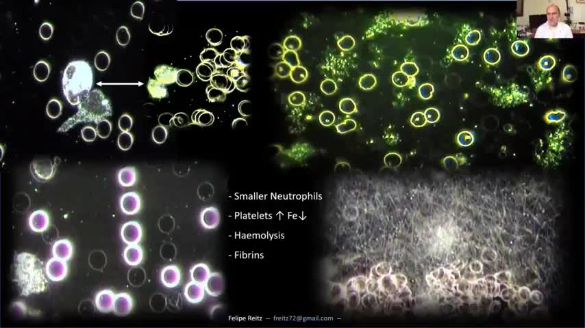 Dr. Felipe Reitz & Dr. Mihalcea - Thermographic Imaging & Blood Analyses