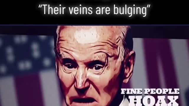 "Their Veins are Bulging"