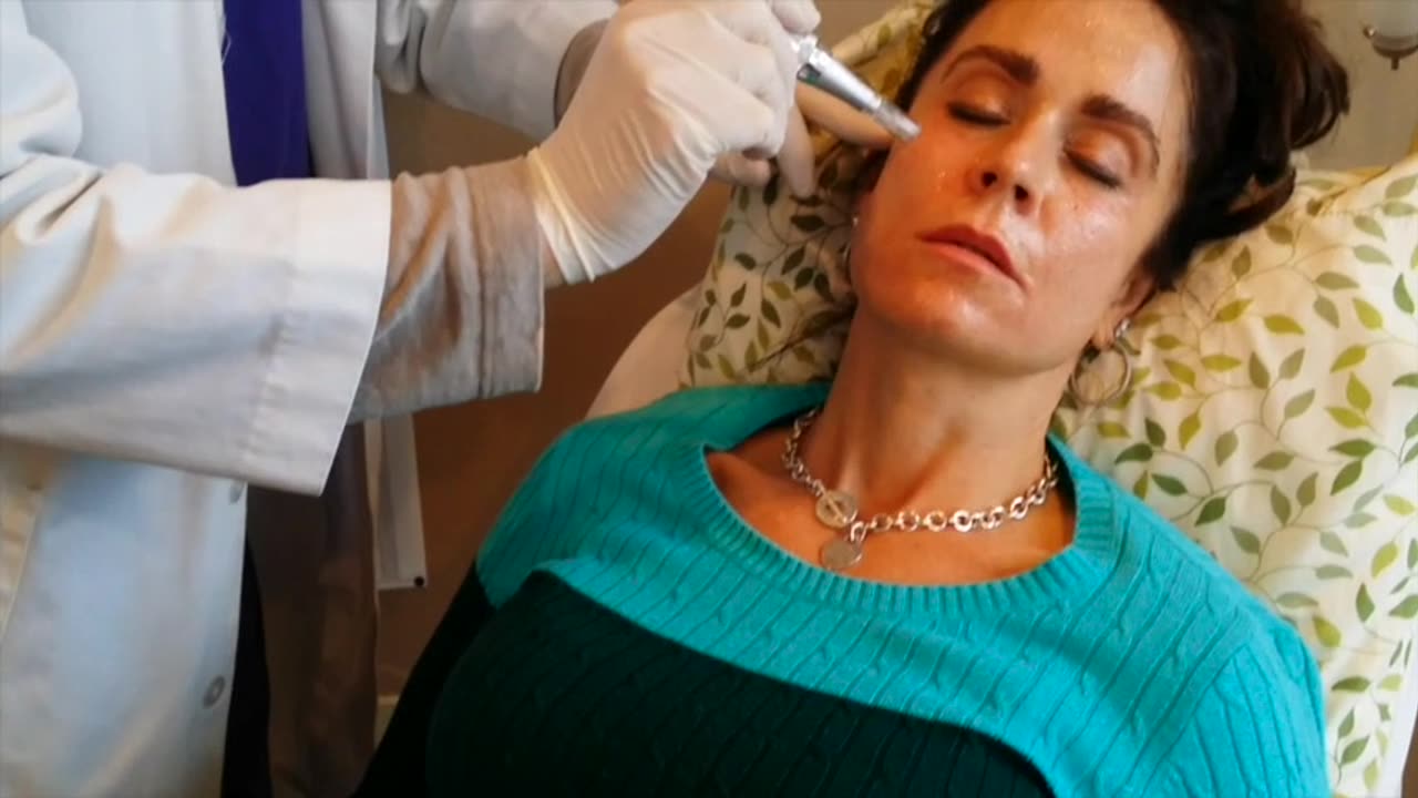 Microneedling LIVE