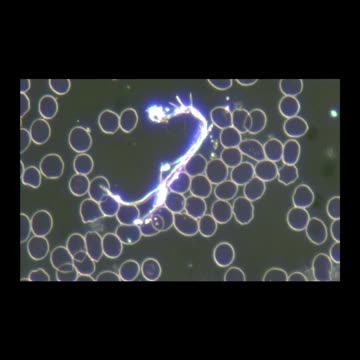 Vaccine Injury Live Blood Analysis 🩸🩸🩸 [Video]