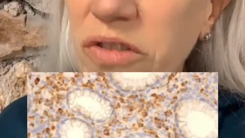 WATCH what they find in cancer cells!!!