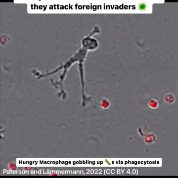 Hungry macrophage gobbling up pathogens 🦠 #shorts