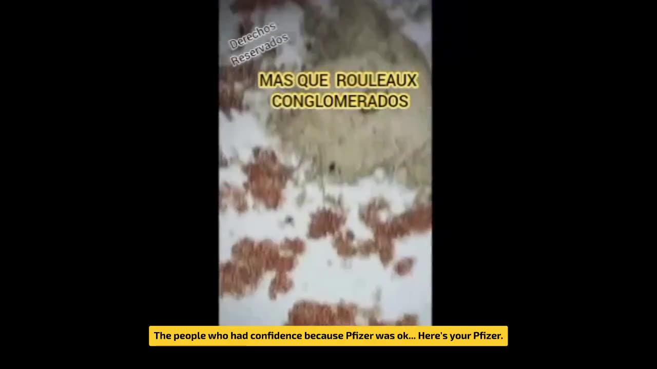 Dr. Wilfredo Stokes Baltazar – 2 Pfizer Jabs & 10 PCR Tests = Total Destruction of Red Blood Cells
