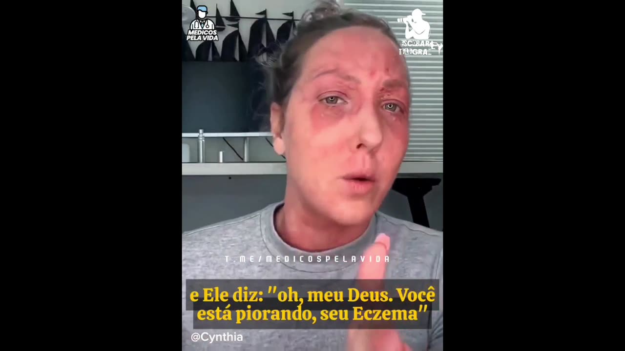 Evolução da vakçin