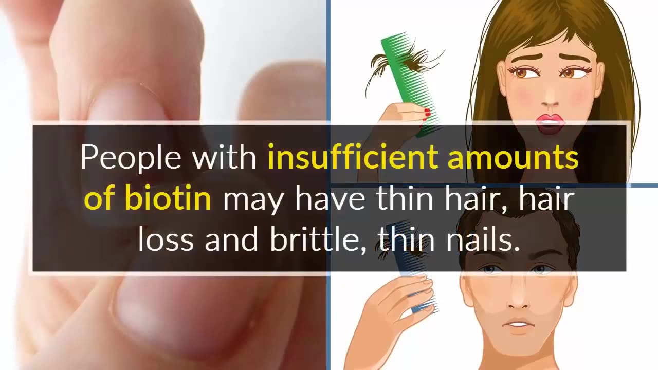 5 Signs of Biotin Deficiency