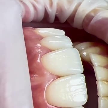 How To Keep Teeth and Gums Healthy and Strong