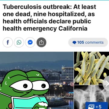 CA - State of Emergency Declared for Tuberculosis Outbreak which Originated from Hotel