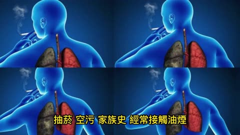 世界癌症日 1/3癌友可治癒
