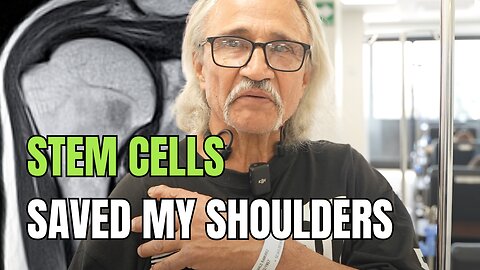 CPI Stem Cells Saved My Shoulders. WITHOUT SURGERY!