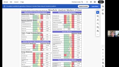 Lab Comparisons with Jon Mitchell PA