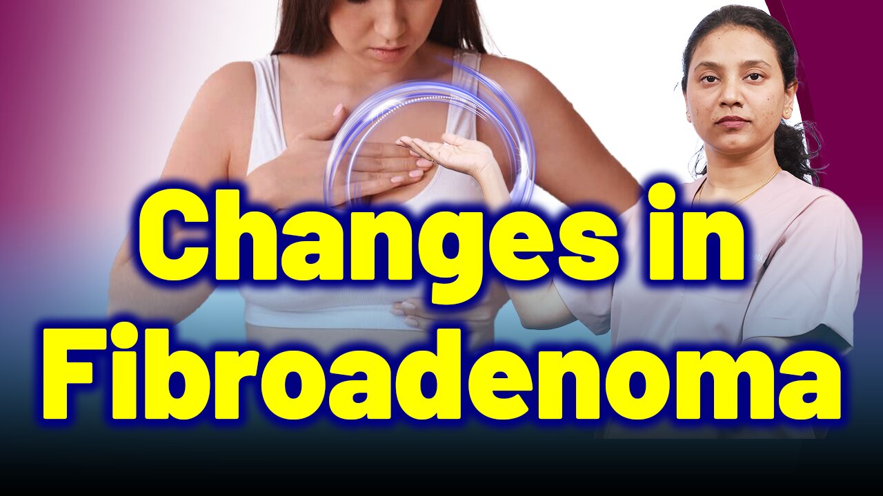 Changes in Fibrodenoma | Treatment Cure Medicine Surgery | Gynaecology Women Female | Homeopathy